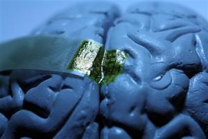 Neural electrode array wrapped onto a model of the brain. The wrapping process occurs spontaneously, driven by dissolution of a thin, supporting base of silk. (C. Conway and J. Rogers, Beckman Institute)